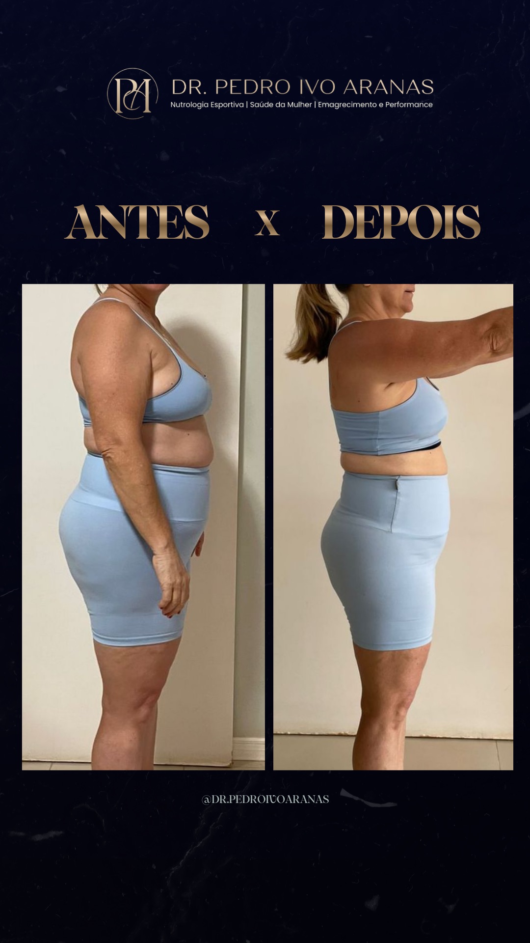 Caso real - Transforma&ccedil;&atilde;o 3