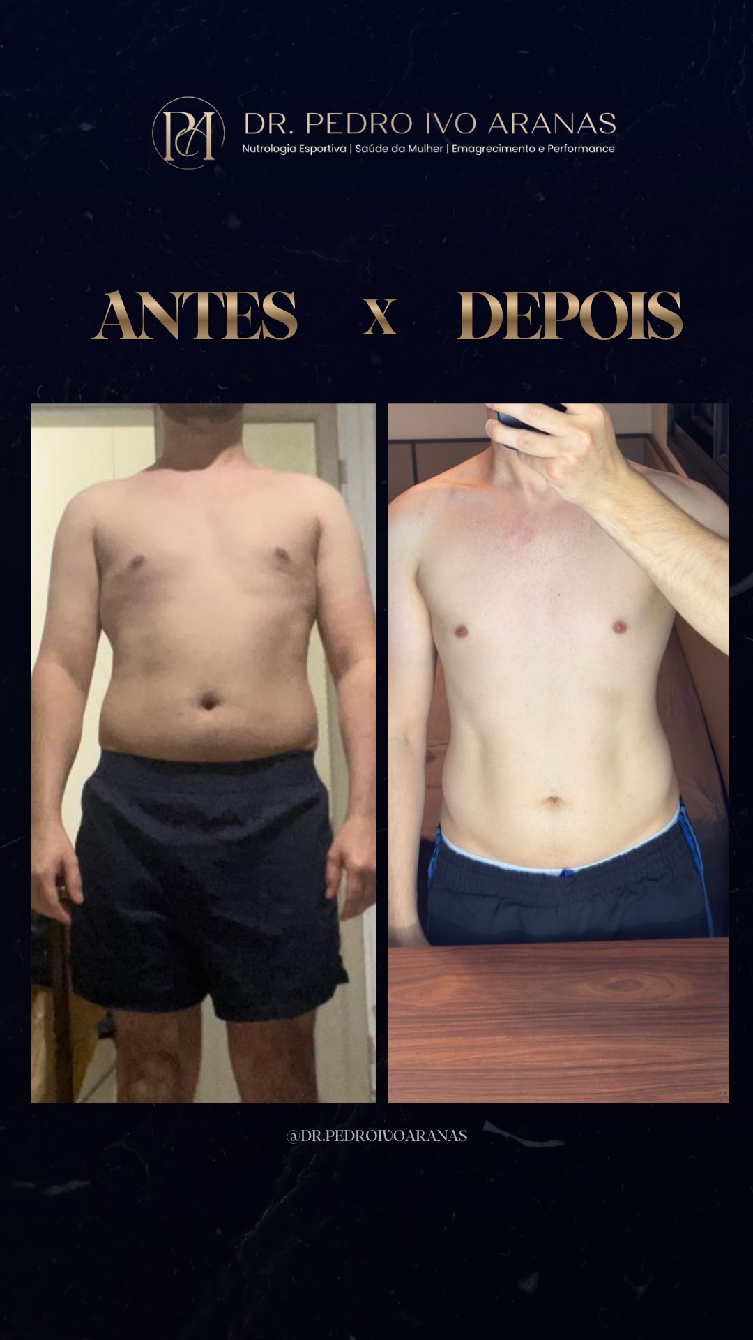 Caso real - Transforma&ccedil;&atilde;o 4