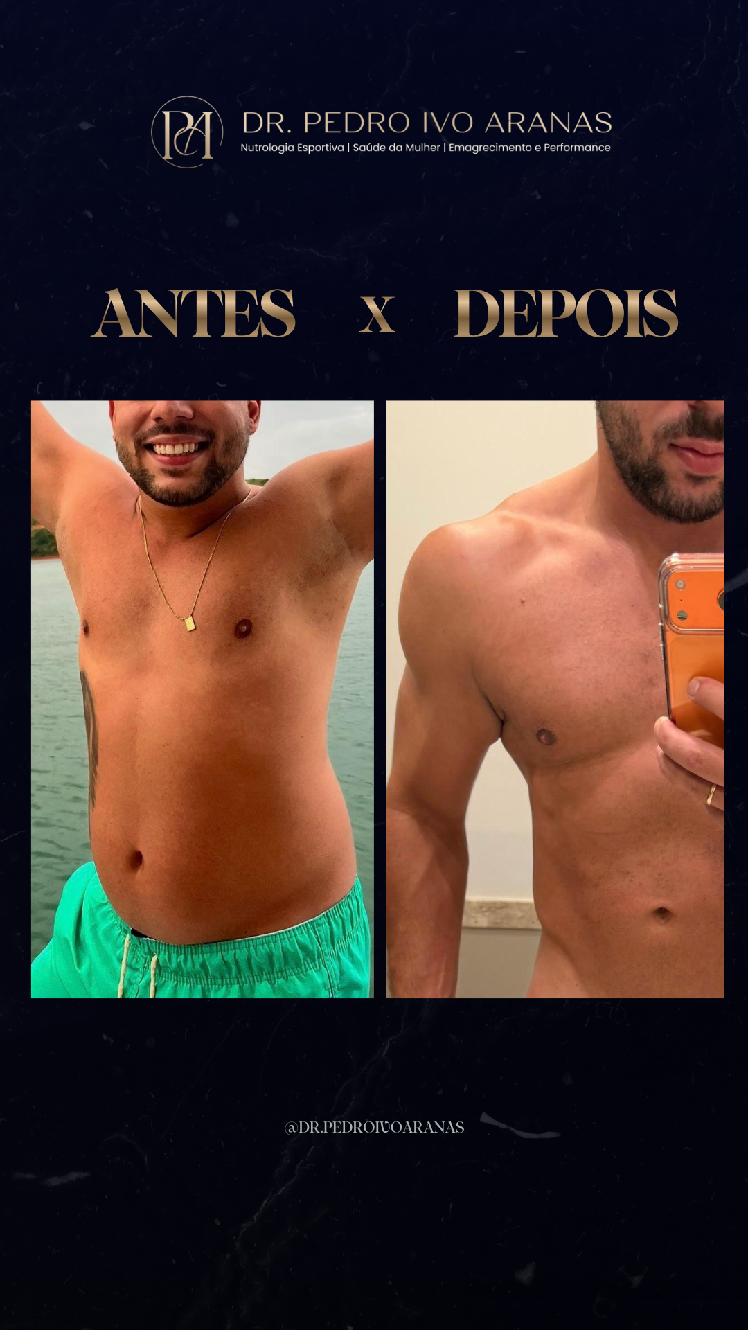 Caso real - Transforma&ccedil;&atilde;o 5